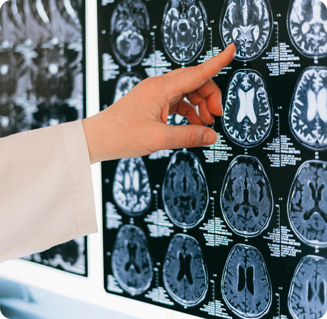 Neurología