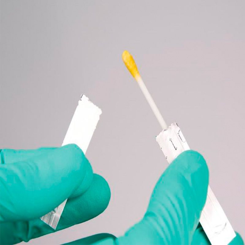 Indicadores de Lavado – Prueba de proteína residual